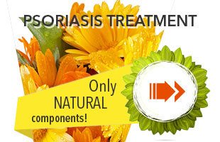 en_psoriasis_treatment_mob